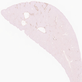 Collagen Hybridizing Peptide Liver Stain